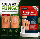 UngiGel: Adesivo reparador de unhas – Tratamento antifúngico avançado