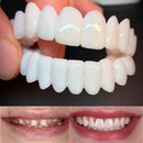 Kit com 2 Placas Dentais de Cerâmica Brancas – PARA TODAS ARCARIAS – Sorriso Perfeito